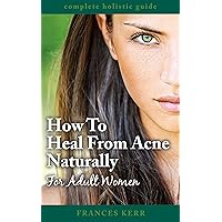 How To Heal From Acne Naturally: For Adult Women How To Heal From Acne Naturally: For Adult Women Kindle