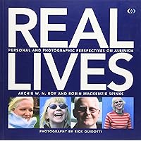 Real Lives: Personal and Photographic Perspectives on Albinism Real Lives: Personal and Photographic Perspectives on Albinism Paperback