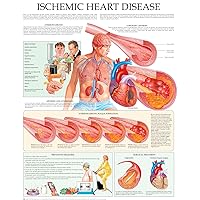 Ischemic heart disease e-chart: Quick reference guide