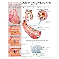 Acute Coronary Syndrome e-chart: Full illustrated Acute Coronary Syndrome e-chart: Full illustrated Kindle