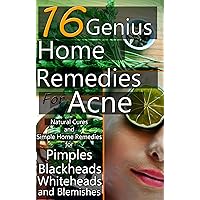 16 Genius Home Remedies for Acne: Natural Cures and Simple Home Remedies for Pimples, Blackheads, Whiteheads, and Blemishes 16 Genius Home Remedies for Acne: Natural Cures and Simple Home Remedies for Pimples, Blackheads, Whiteheads, and Blemishes Kindle