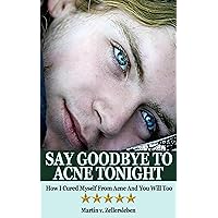 Say Goodbye to Acne Tonight - How I Cured Myself From Acne And You Will Too