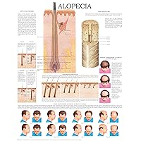 Alopecia men and women e-chart: Quick reference guide