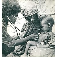 Vintage photo of Picture of an African malnourished child.