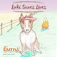 Luki Saves LIves: Burns