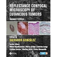 Reflectance Confocal Microscopy of Cutaneous Tumors Reflectance Confocal Microscopy of Cutaneous Tumors Kindle Hardcover