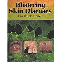 Blistering Skin Diseases Blistering Skin Diseases Hardcover Paperback