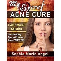 Acne: My Secret Acne Cure: How to Prevent and Cure Acne and Rosacea Naturally